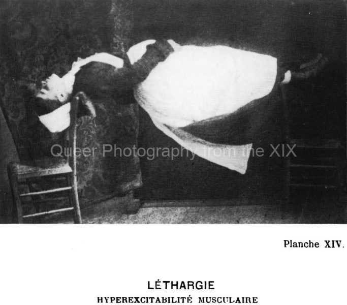 42_Regnard-photograph-of-Augustine-Lethargy-Muscular-Hyperexcitability-Iconographie-vol.-III.