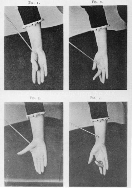 44_Pitres-Effects-of-mechanical-excitation-of-several-of-Marie-Louise-F.-.-.s-hand-muscles-in-the-state-of-catalepsy-Lecons-cliniques-1891.