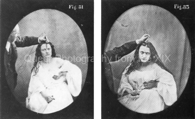 58_Duchenne-de-Boulogne-two-typical-imitations-of-Lady-Macbeth-cruelty-expressions-induced-with-electricity-Mecanismes-de-la-physionomie-humaine-1862